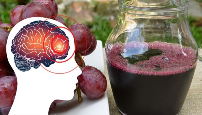 Kāpēc katram, kas cieš no migrēnas, ir jādzer vīnogu sula: te arī rezultāti
