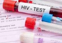 Eiropas testēšanas nedēļā aicina uz bezmaksas HIV testiem Centrāltirgū