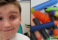 9 gadus vecs zēns zaudēja aci rotaļlietas dēļ, kuru tagad vēlas visi bērni  Vecāki, ņemiet vērā!